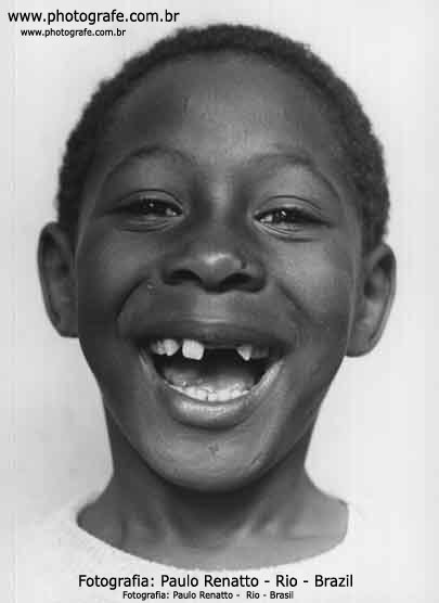 Menino Sorrindo Banguela