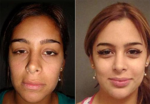 Larissa Riquelme e as Fotos das Plásticas Antes da Fama