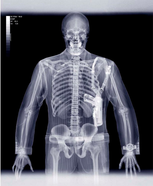 Radiografias e Raio X de Objetos e Animais