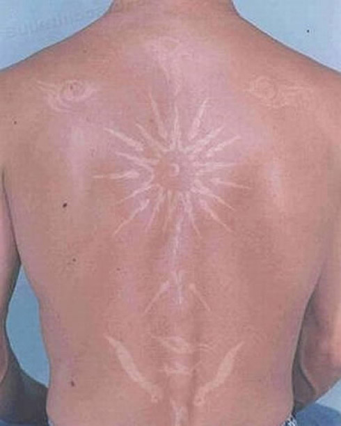 Tatuagem solar: uma moda perigosa