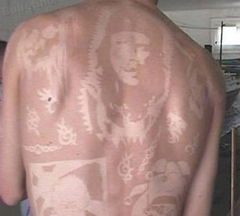 Tatuagem solar: uma moda perigosa