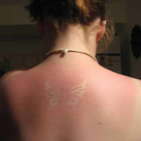 Tatuagem solar: uma moda perigosa