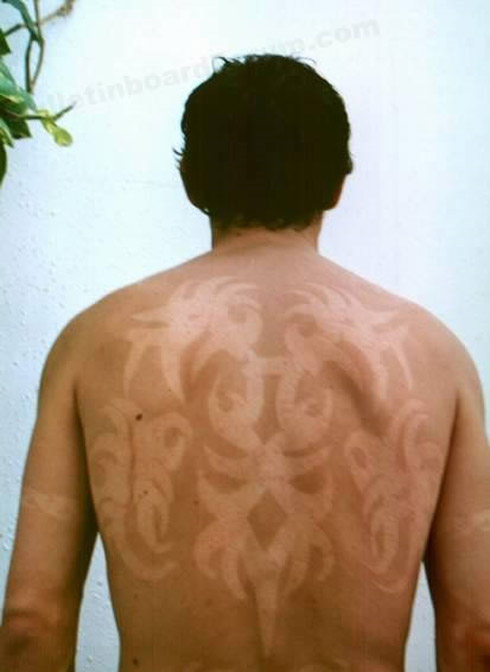 Tatuagem solar: uma moda perigosa