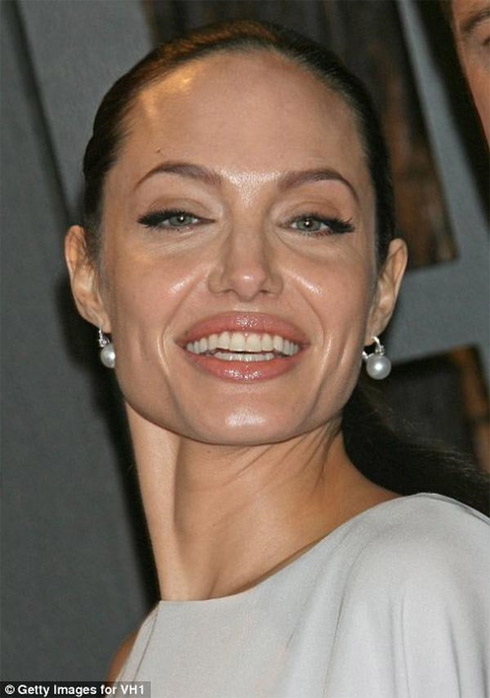 Celebridades em fotos feias