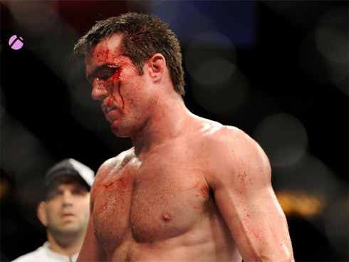 UFC: Os rostos mais detonados do MMA