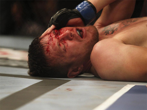UFC: Os rostos mais detonados do MMA