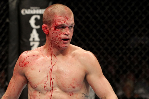 UFC: Os rostos mais detonados do MMA