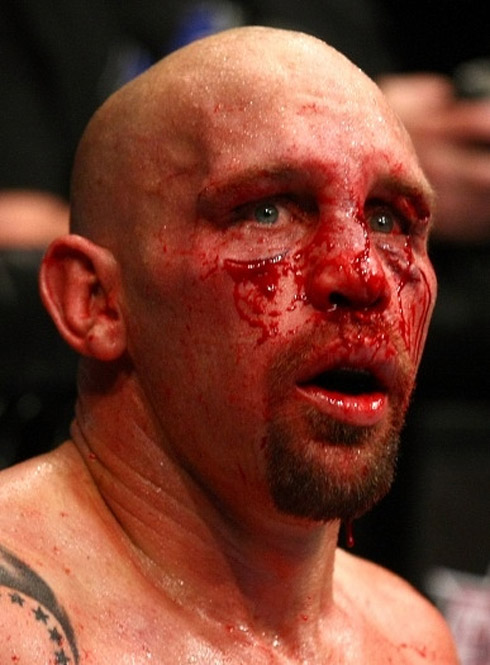 UFC: Os rostos mais detonados do MMA