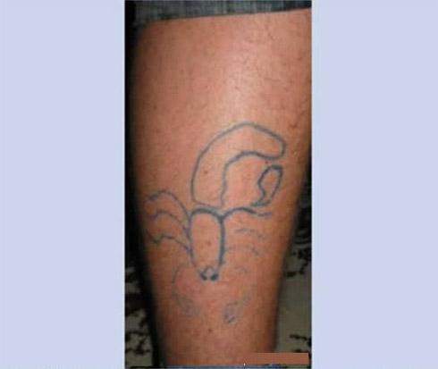 Tatuagens fail: Como não fazer