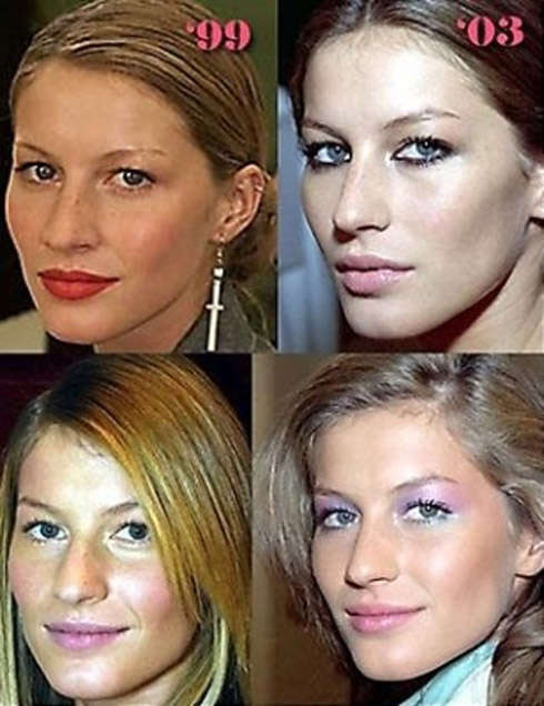 gisele_bundchen_plastic_surgery_