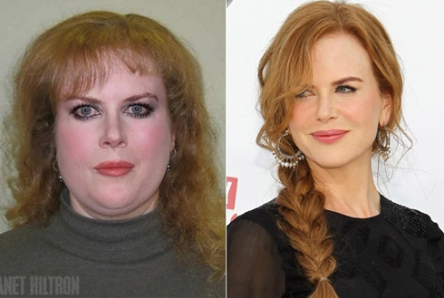 nicole-kidman
