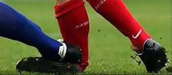 Futebol: Foto de Fratura de Eduardo da Silva do Arsenal Revolta