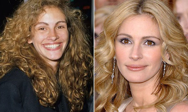 famosas-plastica-nariz-julia-roberts-19278